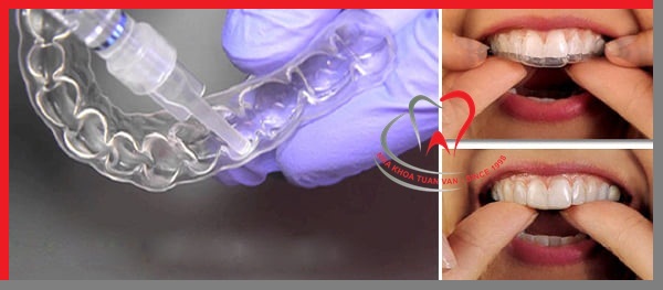 tay-trang-rang-bang-mang-tay