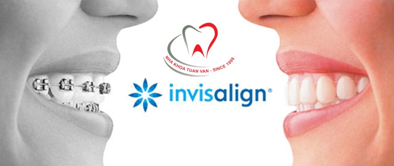 chinh-nha-trong-suot