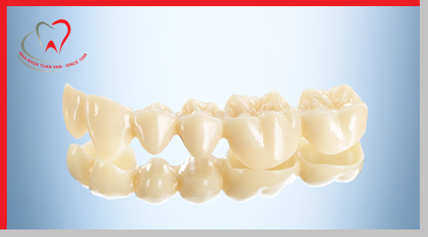 Răng sứ không kim loại Lava Esthetic