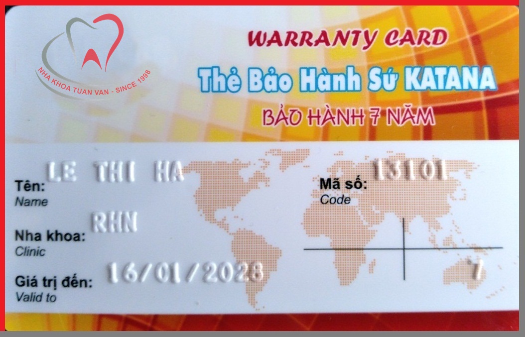 bao-hanh-rang-su