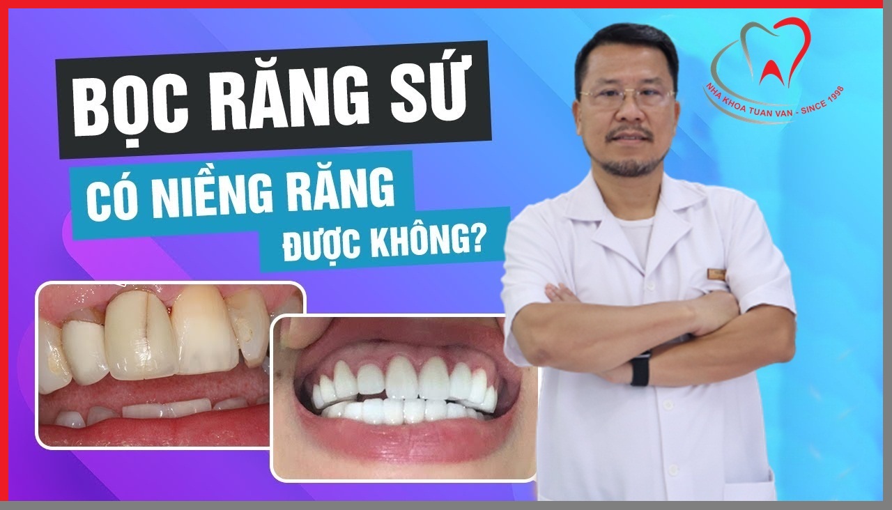 boc-rang-su-co-nieng-duoc-khong