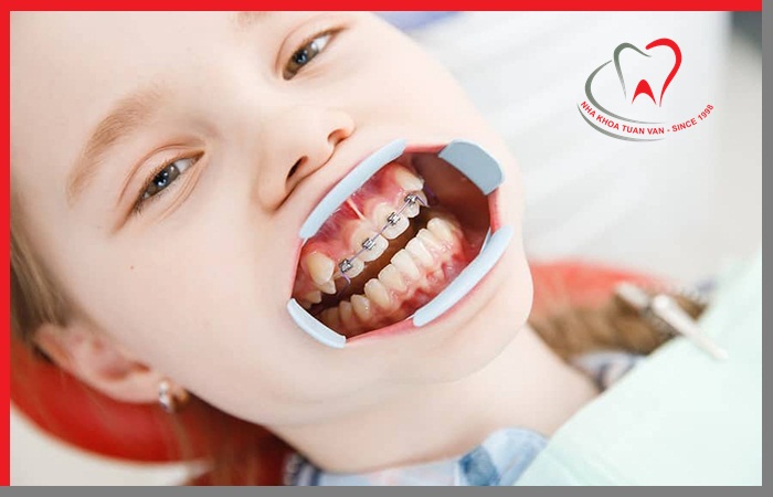 chinh-nha-cho-tre-em