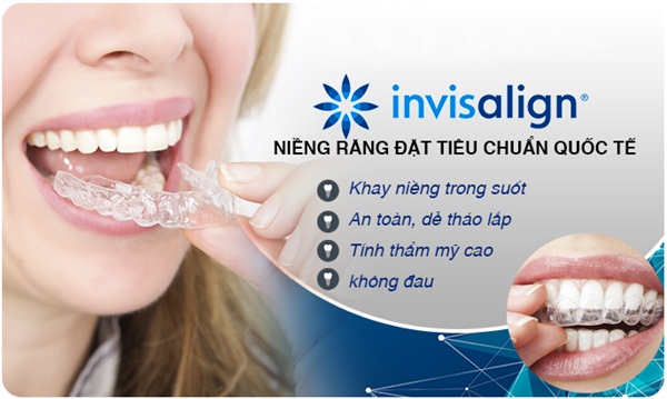 nieng-rang-invisalign