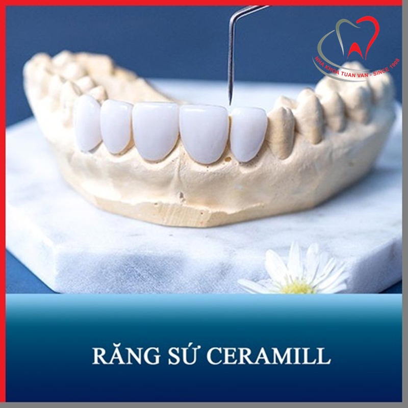 rang-su-ceramill