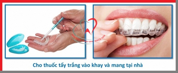 tay-trang-rang-tai-nha