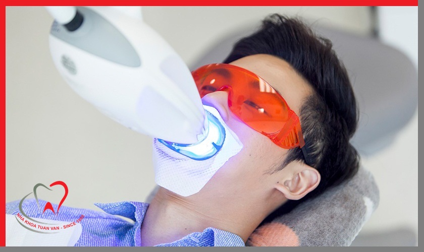 tay-trang-rang-bang-laser