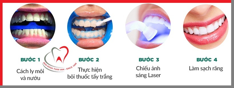 quy-trinh-tay-trang-rang