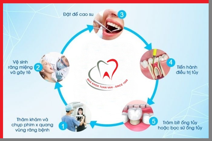 quy-trinh-dieu-tri-tuy-rang