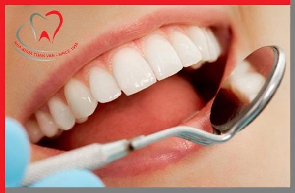 RĂNG SỨ THẨM MỸ