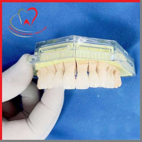 CẢNH GIÁC VỚI NHỮNG QUẢNG CÁO RĂNG SỨ GIÁ RẺ