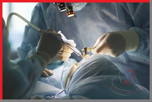 Nên lựa chọn trụ Implant loại nào?