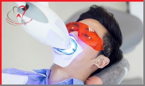 Tẩy trắng răng có làm ảnh hưởng đến men răng?