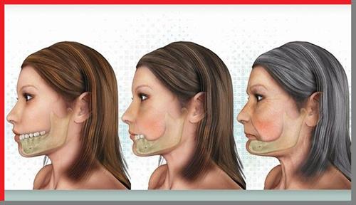 Tiêu xương răng và những điều cần biết