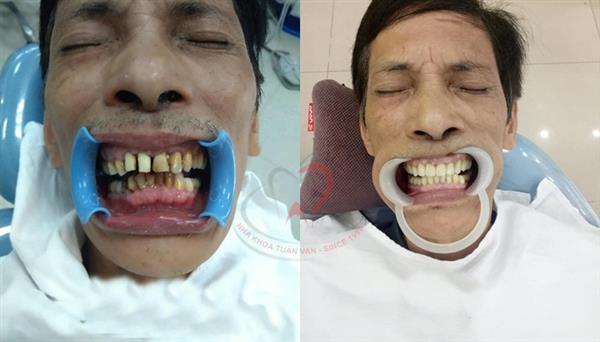 Chú Nguyễn Văn Đông-Trước