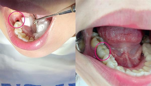 Bạn Nguyễn Thị Quyên-Sau