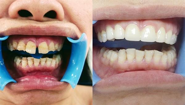 Cô Lê Thị Huệ-Trước