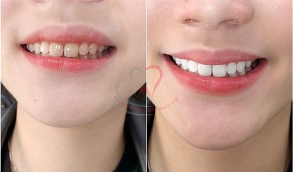 Chị Đỗ Thúy Hằng-Trước