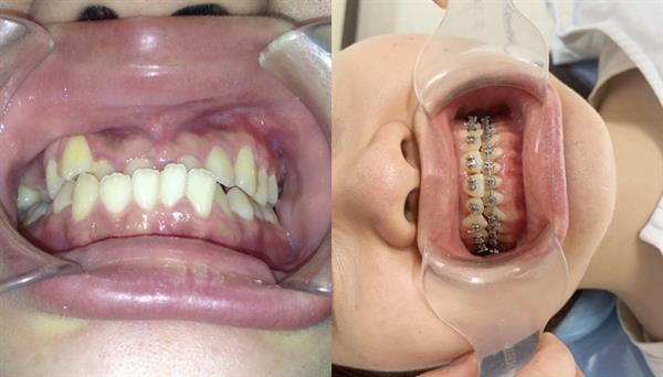 Bạn Nguyễn Thị Thu Hương-Sau