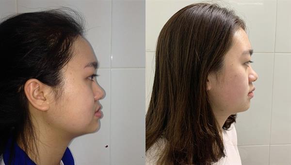 Bạn Nguyễn Thị Thu Hương-Trước